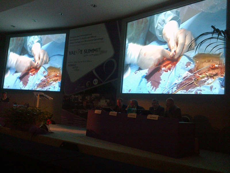 LIVE SURGERY